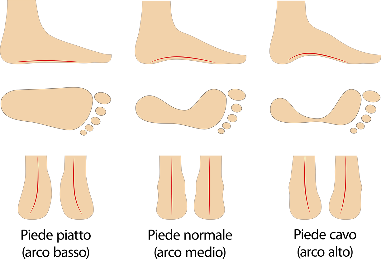 Tipi di piede: piatto-normale-cavo