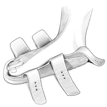 Illustrazione in bianco e nero di un piede appoggiato su un plantare di un sandalo Birkenstock con tutti i cinturini aperti: il piede è centrato correttamente, con qualche millimetro di spazio davanti alle dita e dietro al tallone, senza superare i bordi interni o esterni del plantare.